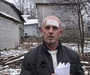 ’Oklagijom mi je razbila glavu’: Muškarac iz BiH tvrdi da je žrtva nasilja