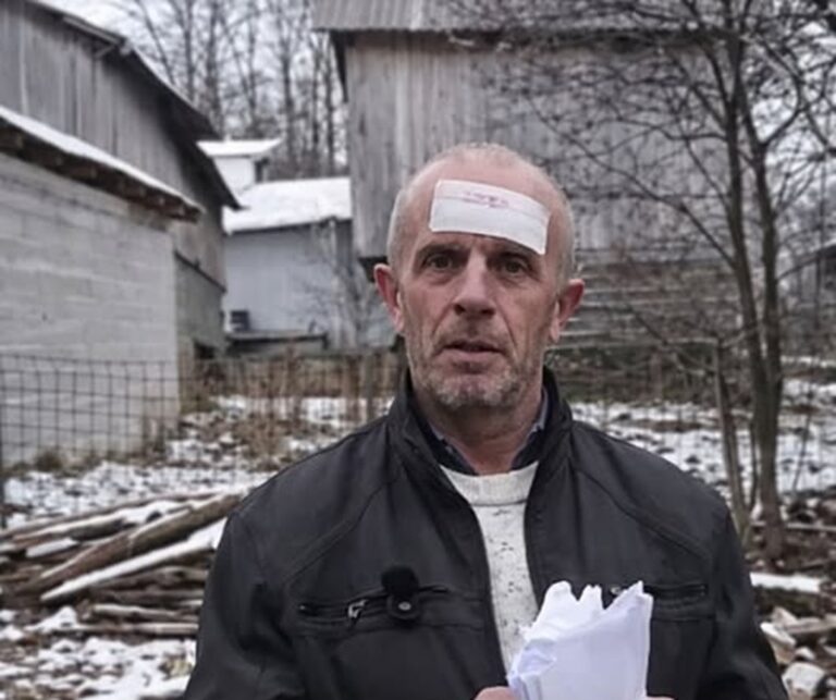 ’Oklagijom mi je razbila glavu’: Muškarac iz BiH tvrdi da je žrtva nasilja